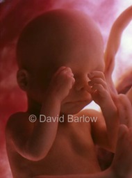 24 week human foetus