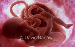 24 week human foetus backlit