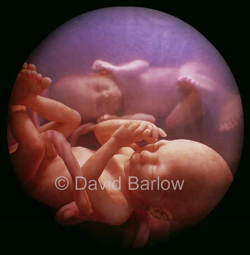 Twin 24 week embryos